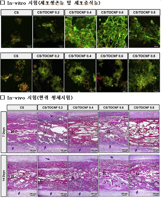수술용 유착 방지제도 나무로 만든다 